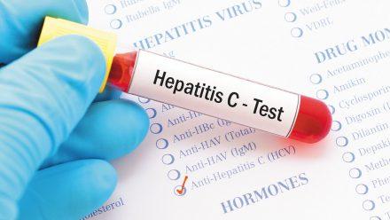 Llaman a prevenir hepatitis y complicaciones como hígado graso